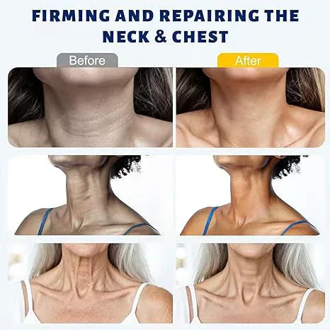 5-Roller Neck Firming Cream – Collagen & Hyaluronic Acid for Smoother, Tighter-Looking Neck Skin