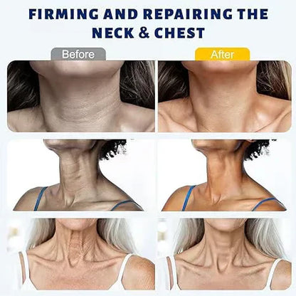 5-Roller Neck Firming Cream – Collagen & Hyaluronic Acid for Smoother, Tighter-Looking Neck Skin