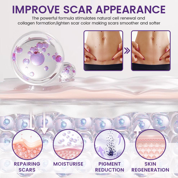 ReGenScar Stem Cell Scar Gel-1