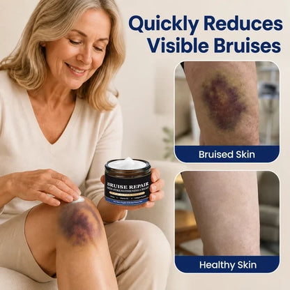 🎃Halloween Special: 80%💜 Visibly Fade Bruises + Strengthen Fragile, Mature Skin