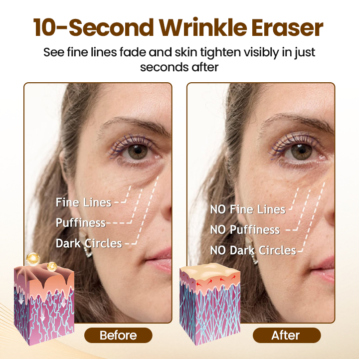 Tiworld® Renewing 10s Wrinkle Serum