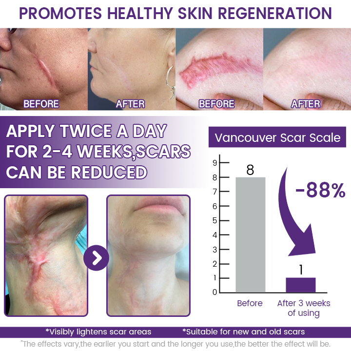 ReGenScar Stem Cell Scar Gel-1