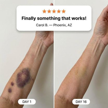 💥100K+ SOLD🔥- Bruise Repair & Skin-Strengthening Cream