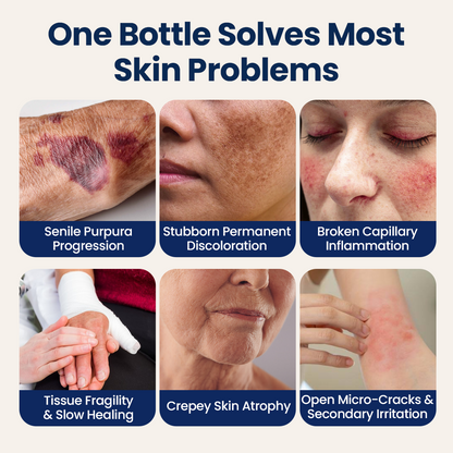 🎃Halloween Special: 80%💜 Visibly Fade Bruises + Strengthen Fragile, Mature Skin