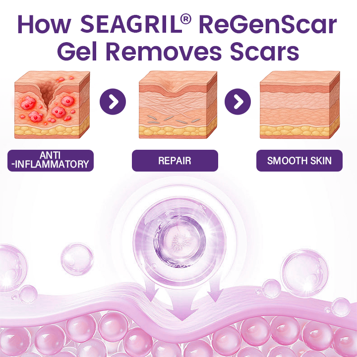 ReGenScar Stem Cell Scar Gel-1