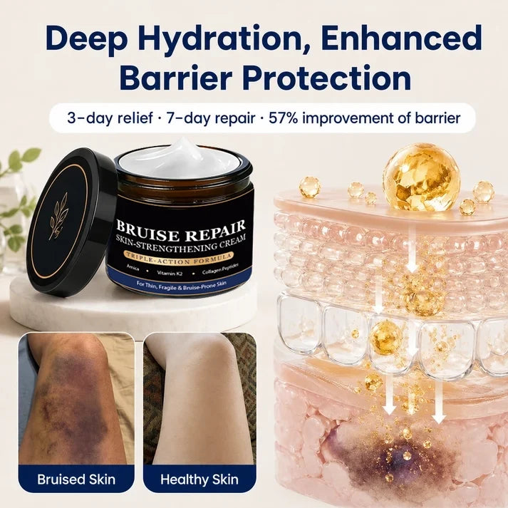 🎃Halloween Special: 80%💜 Visibly Fade Bruises + Strengthen Fragile, Mature Skin